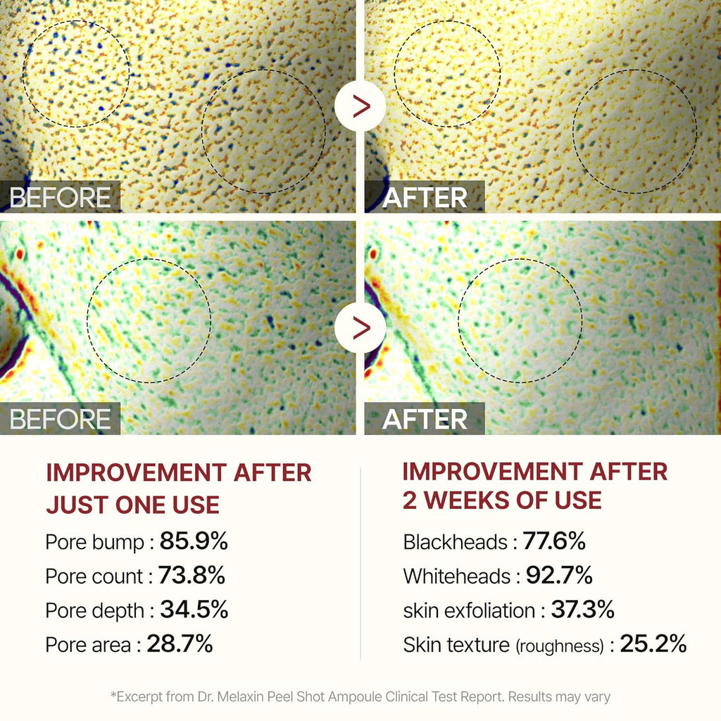 Peel Shot Glow Rice Peeling Ampoule 80Ml Daily Soft Exfoliating Face and Body Scrub Dead Skin Cells Blackhead Remover for All Skin Types Korean Skin Care