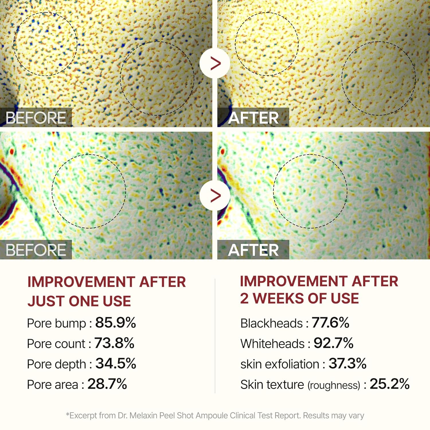 Peel Shot Glow Rice Peeling Ampoule 80Ml Daily Soft Exfoliating Face and Body Scrub Dead Skin Cells Blackhead Remover for All Skin Types Korean Skin Care