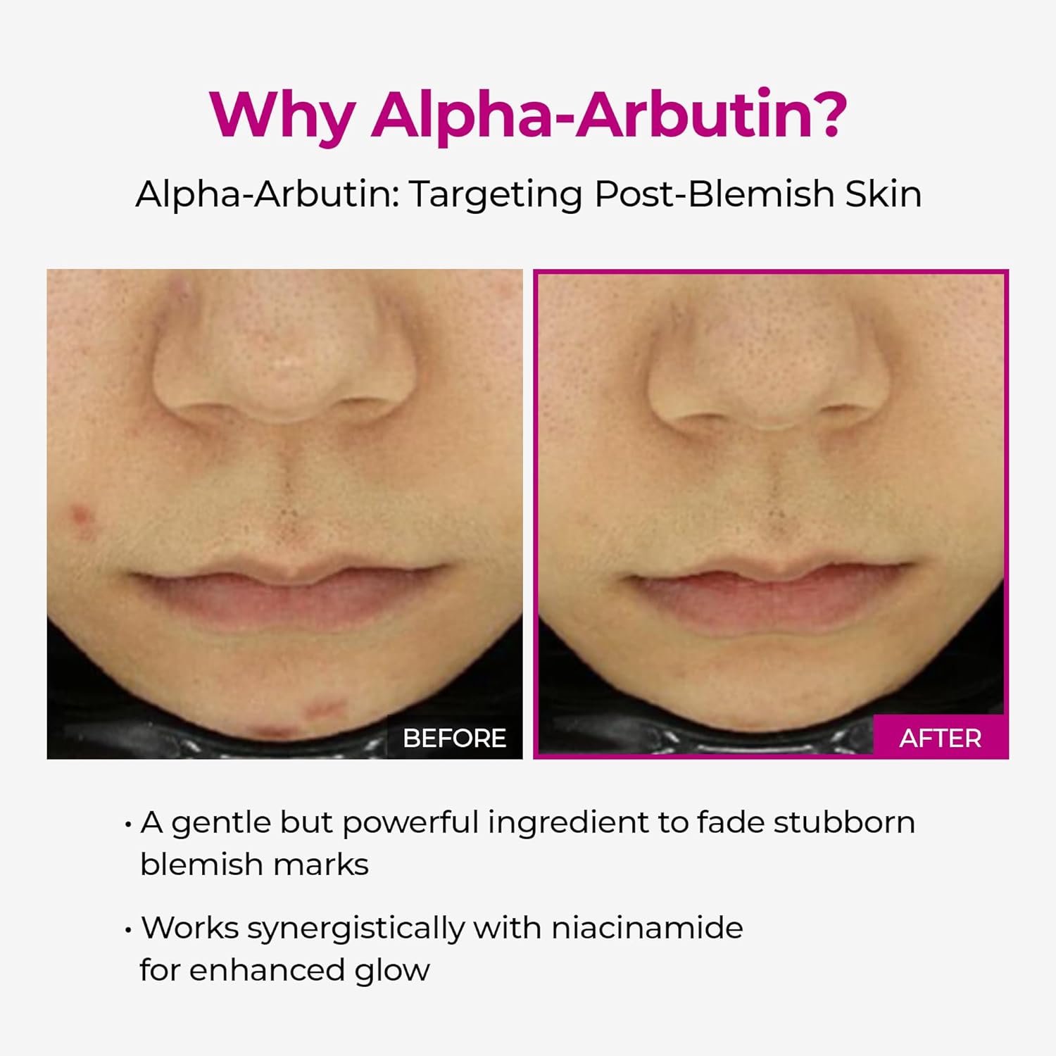 Cemenrete Picotonic Shot Calcium Serum for Dark Spots & Uneven Tone