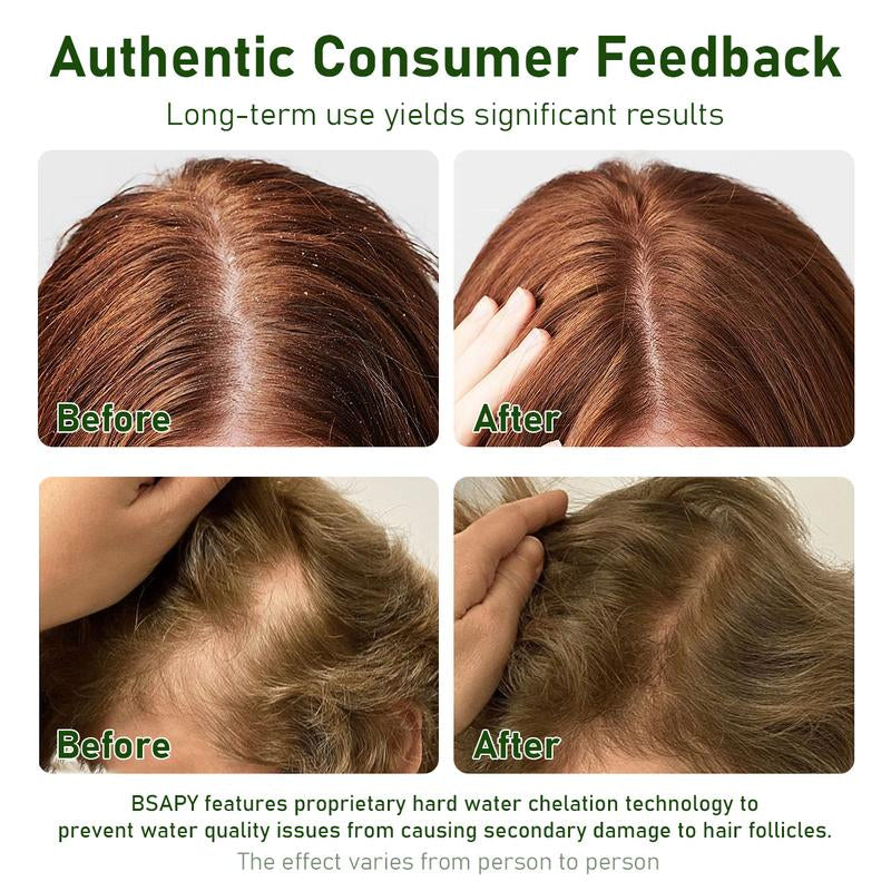 BSAPY Anti-Hair Loss Shampoo Bar