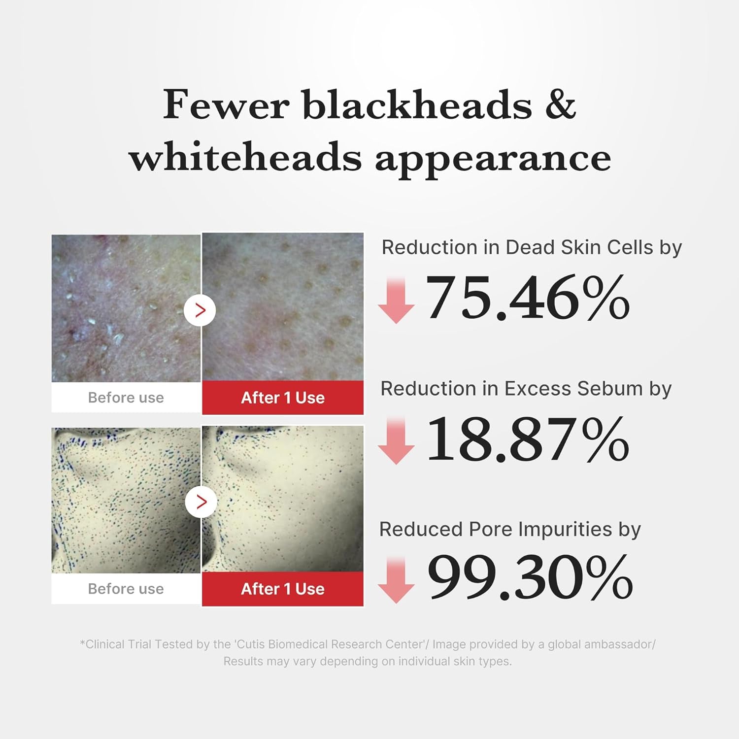 Hypochlorous Acid Rice Peel Shot | Gentle Exfoliating Serum for Dead Skin Cells & Pore Care, Blackheads & Excess Sebum Control | Rice Extract, Panthenol for Hydrating & Smoothing Care